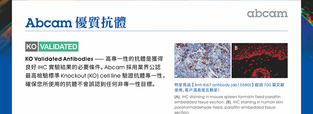 【Abcam優質抗體】KO Validated Antibodies —— 高專一性的抗體是獲得良好 IHC 實驗結果的必要條件。Abcam 採用業界公認最高檢驗標準 Knockout (KO) cell line 驗證抗體專一性，確保您所使用的抗體不會誤認到任何非專一性目標。 ※明星商品【Anti-Ki67 antibody (ab15580)】超過 700 篇文獻使用，客戶滿意度五顆星！