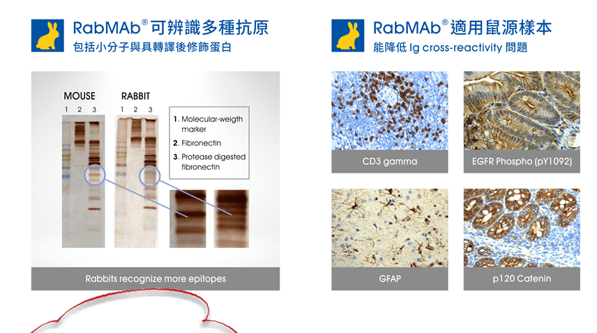 RabMAb® 兔單株一抗優勢 (3)：RabMAb® 可辨識多種抗原，包括小分子與具轉譯後修飾蛋白； RabMAb® 兔單株一抗優勢 (4)：RabMAb® 適用鼠源樣本，能降低 Ig cross-reactivity 問題