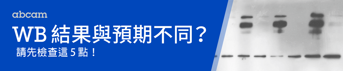 WB 結果與目標蛋白預測位置不同？請先檢查這 5 點