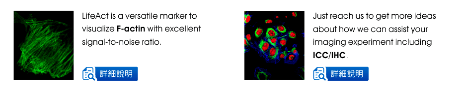 LifeAct is a versatile marker to visualize F-actin with excellent signal-to-noise ratio. | Just reach us to get more ideas about how we can assist your imaging experiment including ICC/IHC.