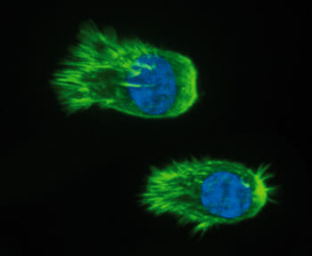 F-Actin Visualization in a 3D Hydrogel Matrix