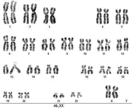 CHM13hTERT cell line retains a 46,XX karyotype and near-complete homozygosity.