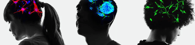 Abcam 神經退化性疾病互動式海報 (二) 肌萎縮性側索硬化症 (Amyotrophic Lateral Sclerosis) • 多發性硬化症 (Multiple Sclerosis) • 亨丁頓舞蹈症 (Huntington's Disease) - Abcam 台灣代理伯森生技