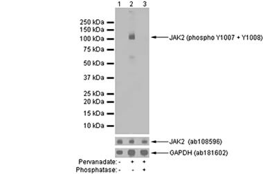 磷酸化 JAK2 蛋白質  WB 檢測
