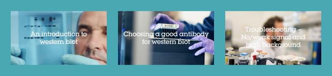 【Abcam 學術講座】Western Blotting - Optimization Tips and Useful Tools - Abcam 台灣代理伯森生技