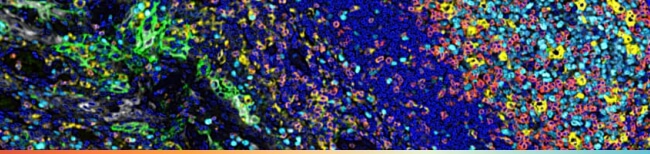 【Multiplex IHC 驗證抗體特輯】從臨床試驗到 IVD 應用，解鎖 Multiplex IHC 的價值與挑戰