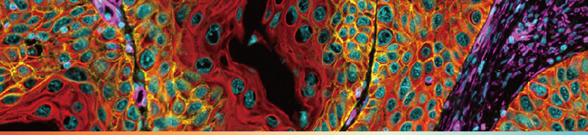 【abcam • Leica 聯合線上講座】Mastering Multiplex Immunofluorescence: Techniques and Troubleshooting