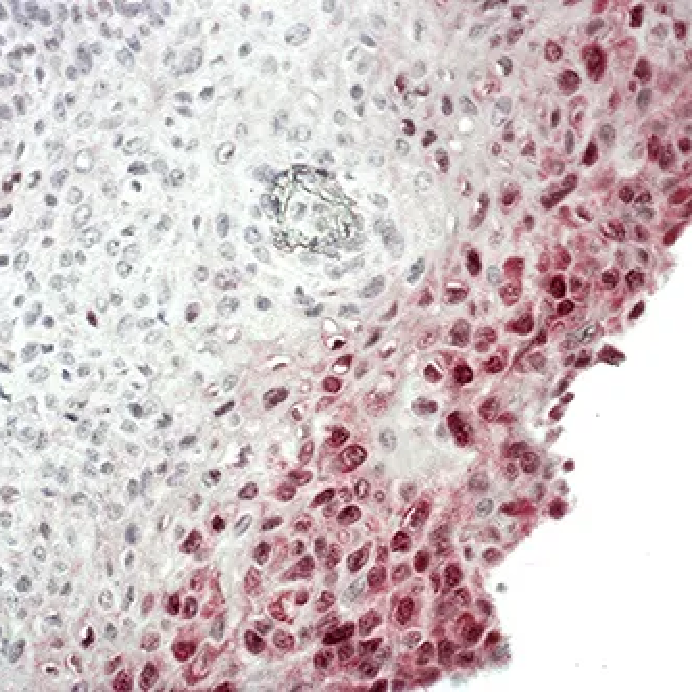 MAMPIVIEW® HPV High Risk RNA Probes