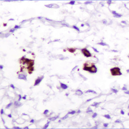 AMPIVIEW® SARS-CoV-2 RNA Probes
