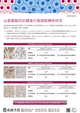 癌細胞轉移研究抗體