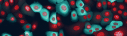 高内涵影像分析應用實例 — 以 FRET 生物感測器分析活細胞內 ERK 訊息傳導路徑