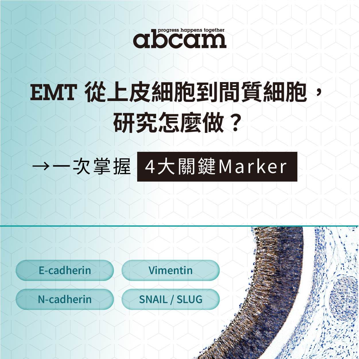 EMT 從上皮細胞到間質細胞，研究怎麼做？4大關鍵 Marker 一次掌握｜Abcam